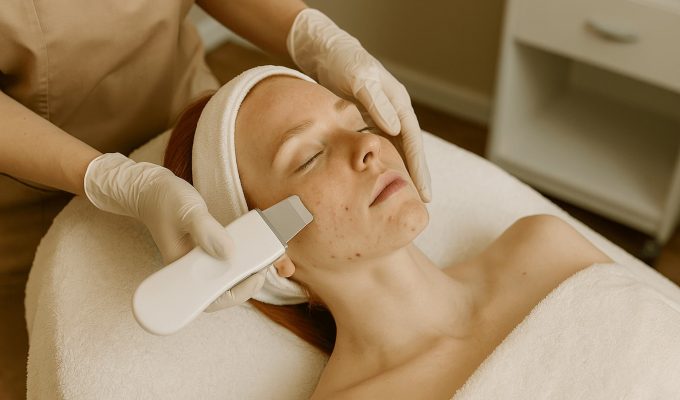 aknés bőrprobléma